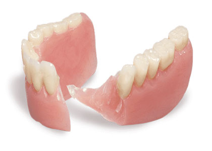 a broken denture needing repair at dieppe denture clinic