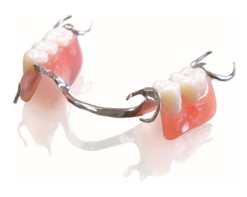 partial dentures made at Dieppe Denture Clinic