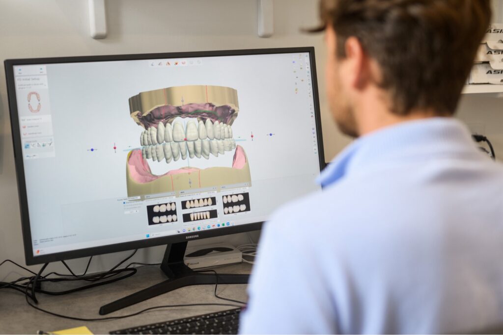 Joel Ouellette, Denturist working on digital dentures at Dieppe Denture Clinic